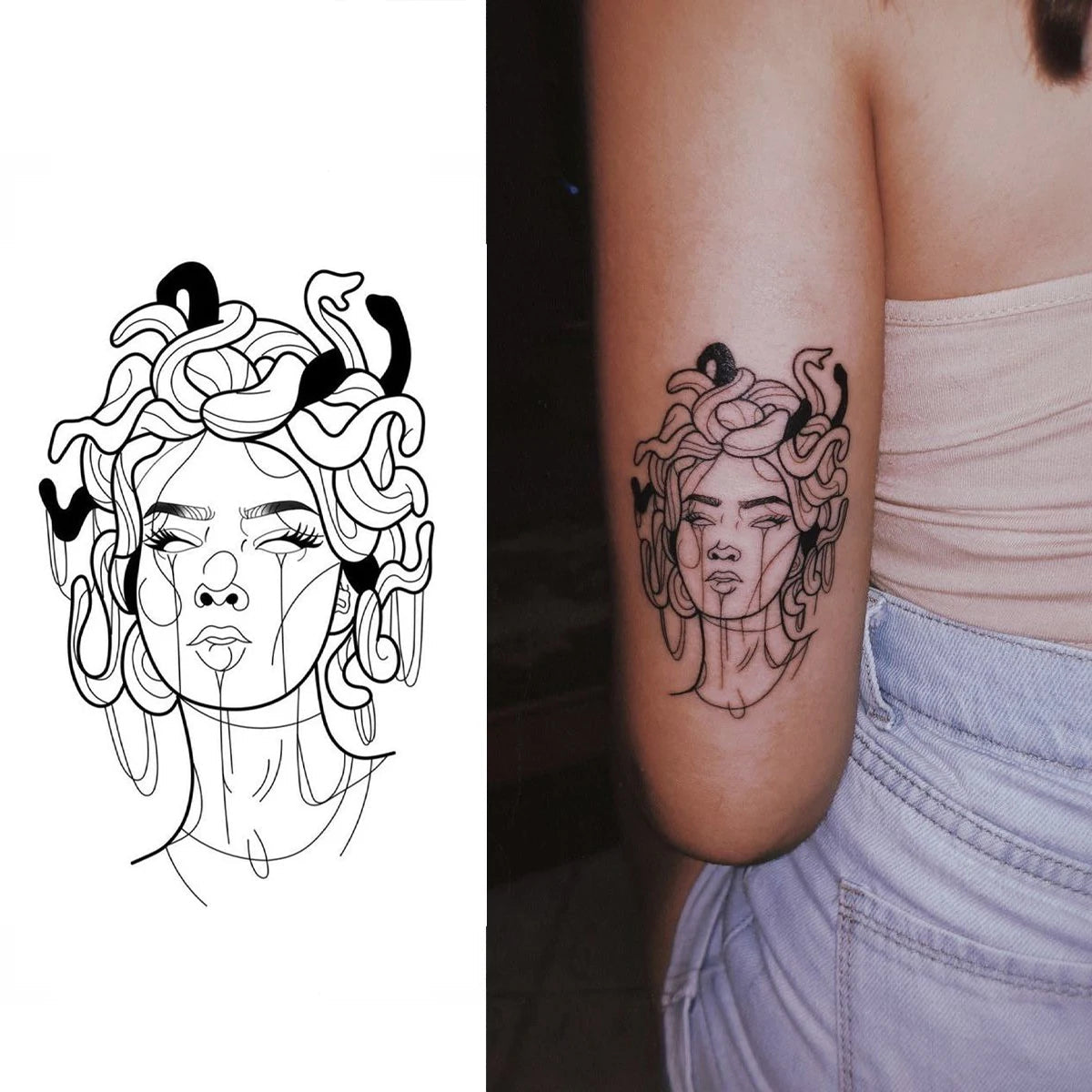 Medusa's Gaze